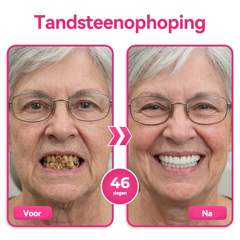 🦷 Natravor® Thismile NH-10 Tandpastaserum voor de verzorging van tandglazuur en tandvlees – Geavanceerde therapie
