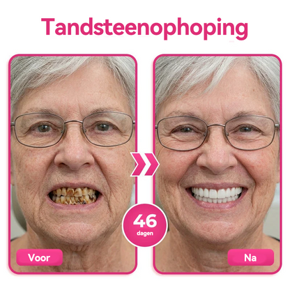🦷 Natravor® Thismile NH-10 Tandpastaserum voor de verzorging van tandglazuur en tandvlees – Geavanceerde therapie