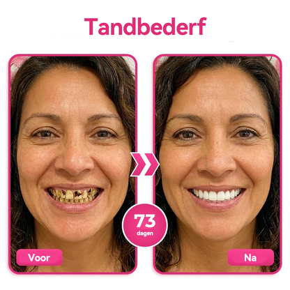 🦷 Natravor® Thismile NH-10 Tandpastaserum voor de verzorging van tandglazuur en tandvlees – Geavanceerde therapie