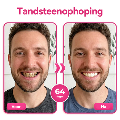 🦷 Natravor® Thismile NH-10 Tandpastaserum voor de verzorging van tandglazuur en tandvlees – Geavanceerde therapie