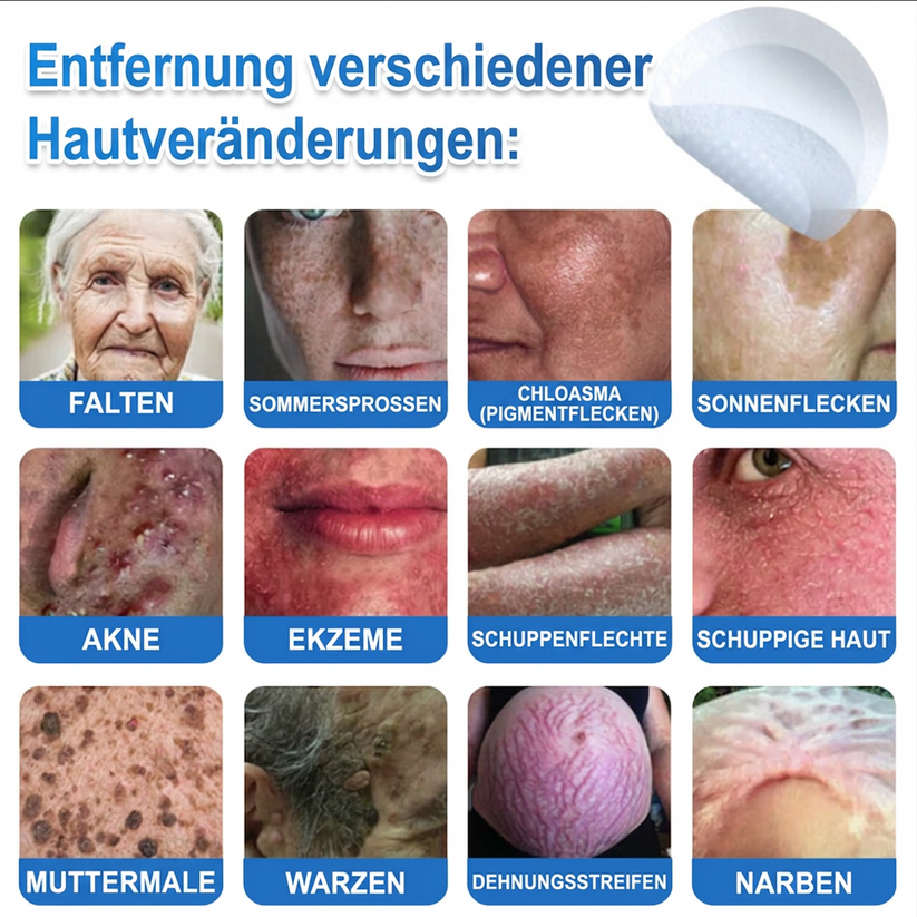 🧑‍⚕️ TopSpire® 2-in-1 micronaald- & hydrocolloïdpleisters | Verwijderaar voor verheven moedervlekken, acne, platte wratten & steelwratjes  Verbetert het uiterlijk van rimpels