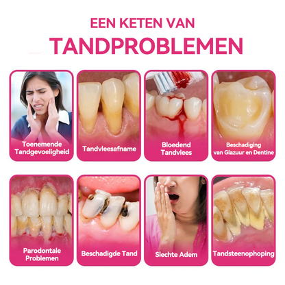 🦷 Natravor® Thismile NH-10 Tandpastaserum voor de verzorging van tandglazuur en tandvlees – Geavanceerde therapie